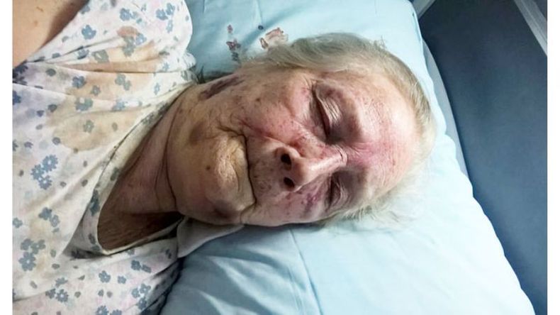 VÍCTIMA. El ataque a una anciana generó la reacción del Ombudsman. .