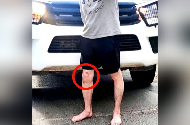 El hombre no pudo explicar lo ocurrido y el origen de las heridas.&nbsp;