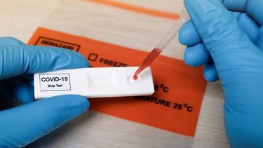 A MEDIAS. El test de anticuerpos es rápido, pero no muestra todos los datos. .