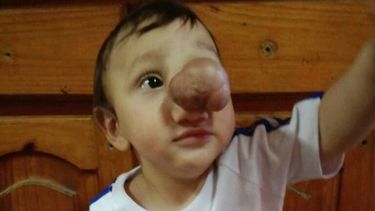 Román fue operado con éxito el último viernes. .