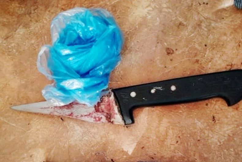 La víctima permanece internada en el Hospital Central de Pilar.&nbsp;