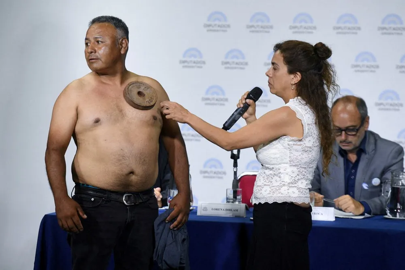 ESCENA EN EL CONGRESO. Las supuestas pruebas de a “magnetización” de un hombre.