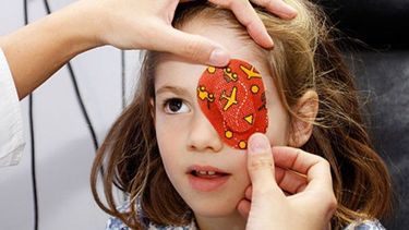 PARCHE. Cubrir un ojo es parte del tratamiento para la ambliopía..