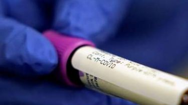 Catorce personas murieron y 104 fueron diagnosticadas con coronavirus