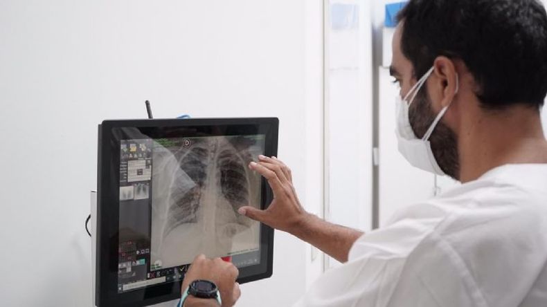 El Hospital de Derqui incorporó un nuevo equipo de Rayos..