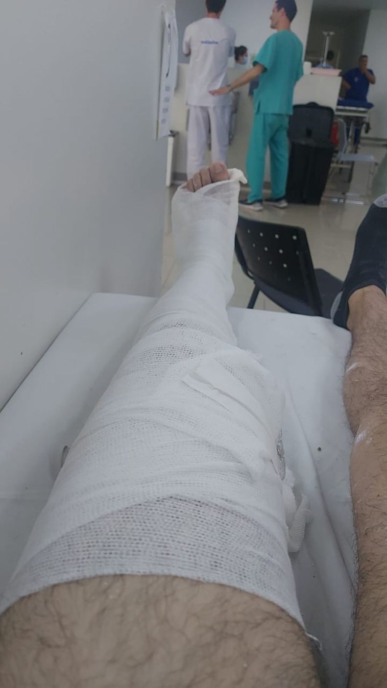 La víctima sufrió fractura de rodilla y debe ser intervenido quirúrgicamente.&nbsp;