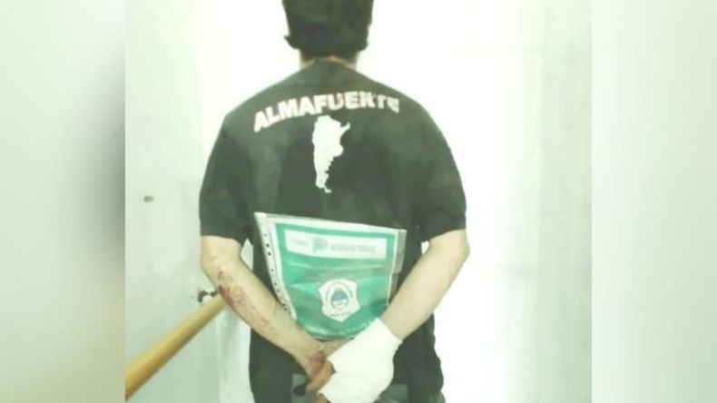 HERIDO. El detenido tiene 38 años y es del mismo barrio. .