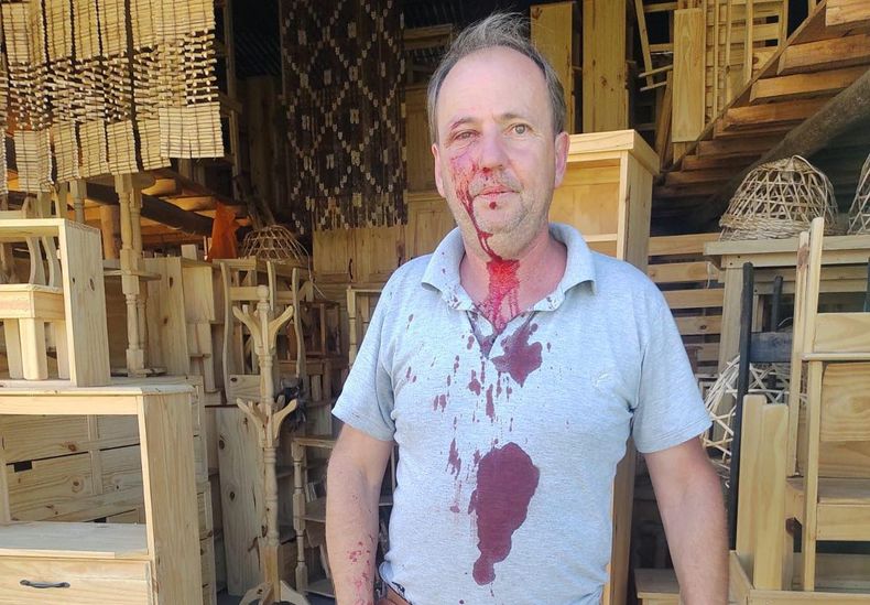 HERIDO. La víctima sufrió un golpe en el rostro.