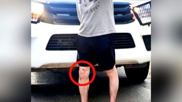 El hombre no pudo explicar lo ocurrido y el origen de las heridas.&nbsp;