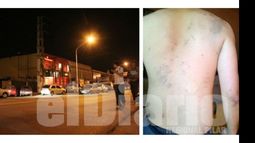 A LOS GOLPES. El corredor sigue siendo escenario de violencia. Así quedó Gianfranco..