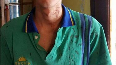 VÍCTIMA. La sangre en el uniforme de una de las víctimas de la golpiza..