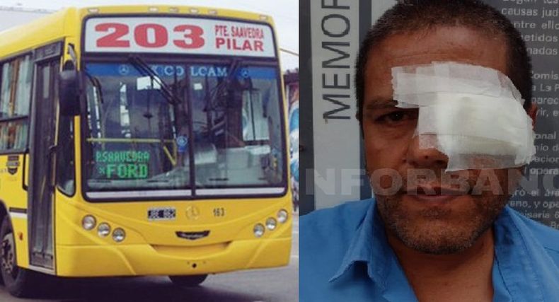El colectivero fue herido en uno de sus ojos por las esquirlas de un vidrio.