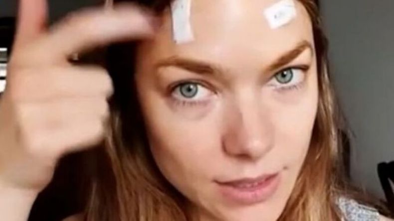 Luli mostró las marcas de los carcinomas que le extrajeron. .