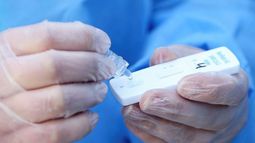 El test rápido tiene un costo de 2700 pesos. .