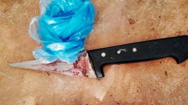 La víctima permanece internada en el Hospital Central de Pilar.&nbsp;