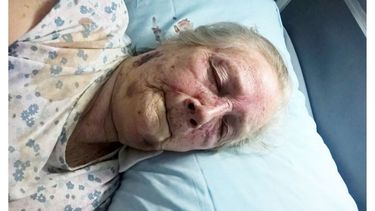 VÍCTIMA. El ataque a una anciana generó la reacción del Ombudsman. .