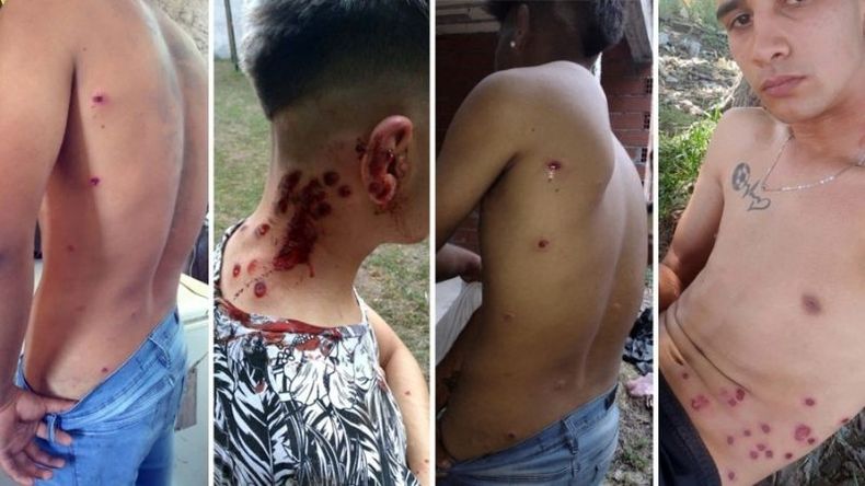 Algunas consecuencias de la balacera contra los participantes de la fiesta..