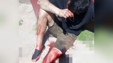 Pablo Castellano de 34 años fue apuñalado en la pierna por parte de su amigo de 38 años. .