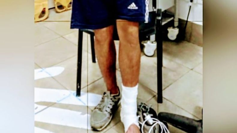 BALAZO. El delincuente recibió un disparo en el tobillo izquierdo. .