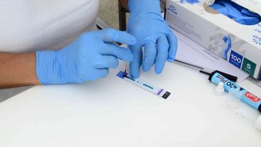 Los tres estudios para el control y seguimiento de pacientes con VIH será llevado a cabo por la Provincia.