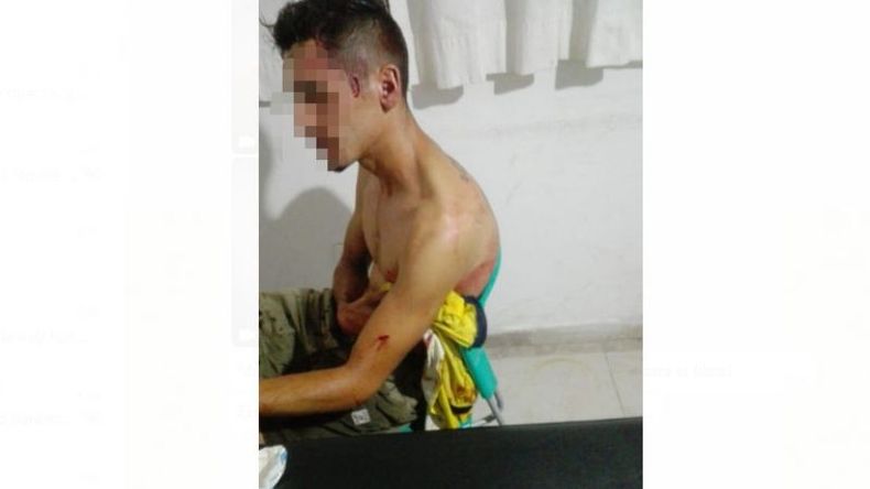 Uno de los heridos en la pelea, cuando ya estaba siendo atendido..