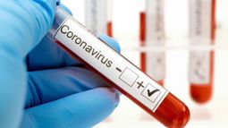 Once muertos y récord de 240 nuevos contagios