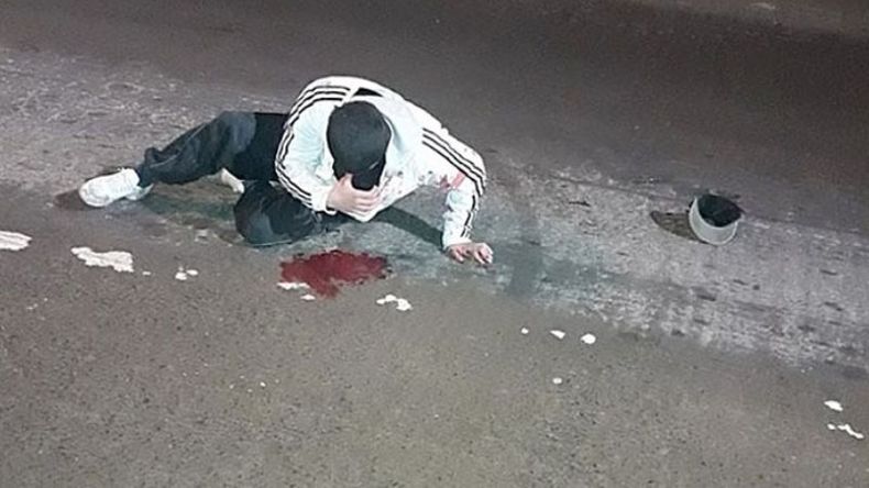 HERIDO. Uno de los ladrones golpeado por un hombre, en Derqui. .
