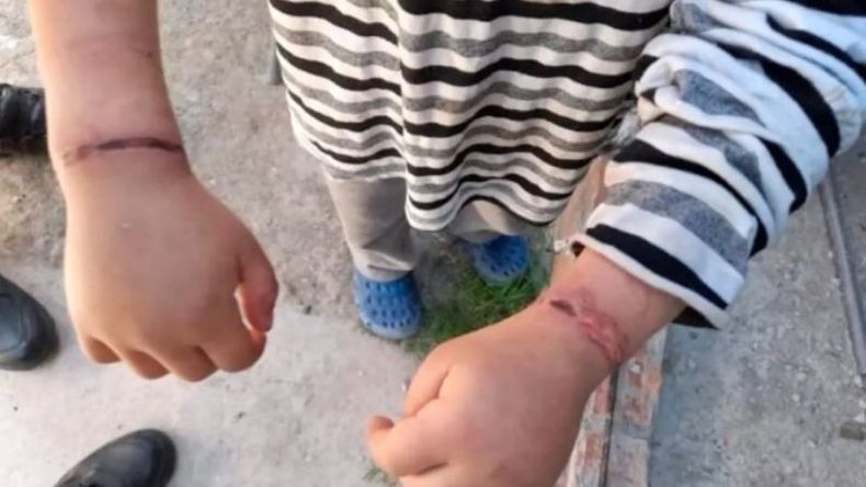 El nene tenía sus muñecas aferradas con alambres..
