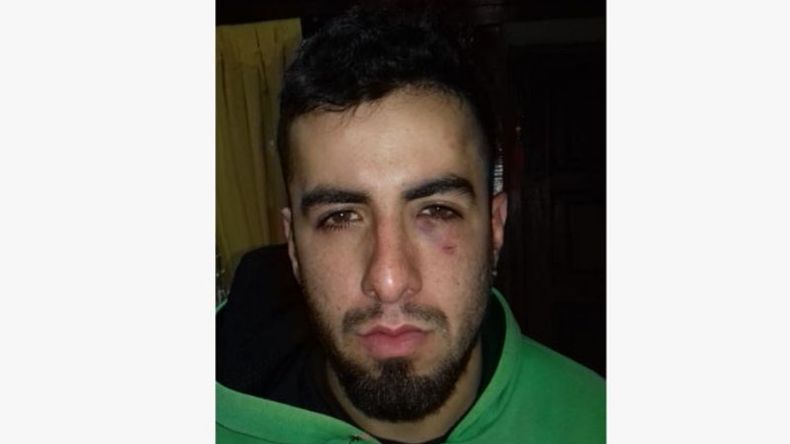 Rostro de la víctima..