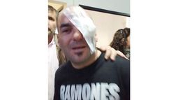 GAS PIMIENTA. Un vecino agredido. .