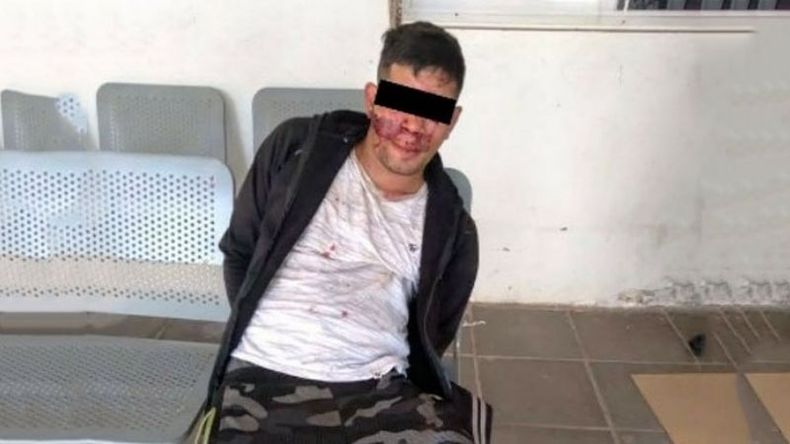 El hombre de 25 años no sufrió heridas de gravedad. .