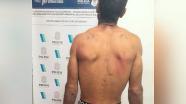 El sujeto detenido intentó agredir a los policías y al personal de la ambulancia, además de amenazar de muerte a su ex.