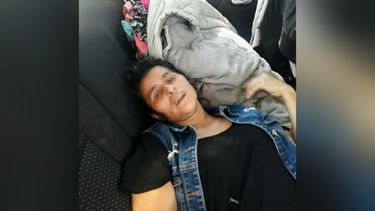 La mujer sufrió un corte en la pierna al intentar escapar..
