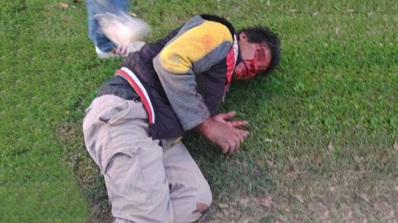 Vecinos intentaron linchar a Jaime cuando fue descubierto en la calle (foto @pampamonaco)..