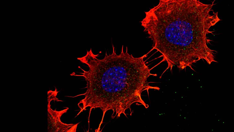 Hallazgo para una nueva terapia contra el cáncer de colon. (Noticias Argentinas)..webp