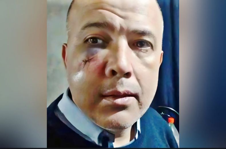 Se sospecha que el agresor podría haber actuado con una manopla por la magnitud de las heridas que sufrió el chofer.&nbsp;