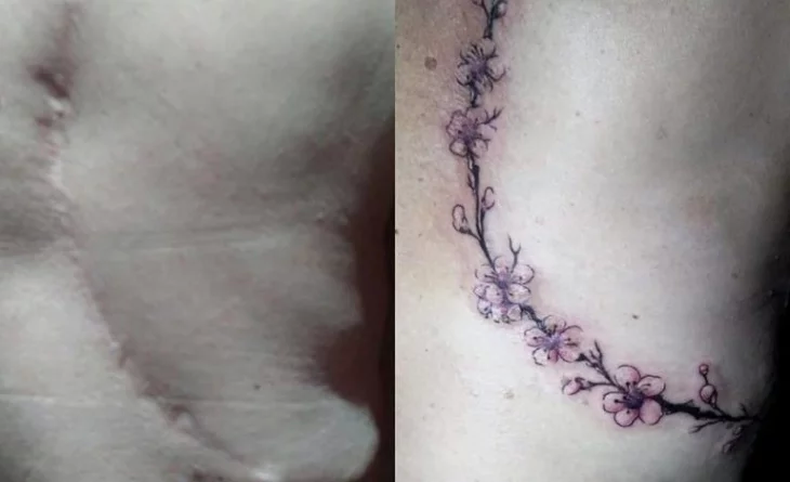 Tatuajes sanadores. (el1digital.com.ar)..webp
