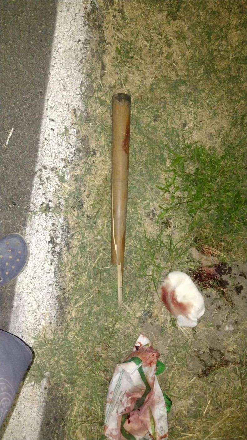 El bate utilizado para concretar el brutal ataque.