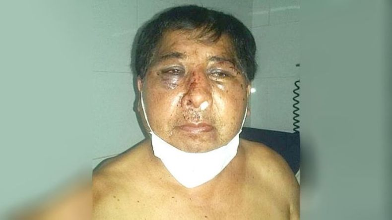 MALHERIDO. Oscar Mánquez fue ferozmente atacado por los agresores..