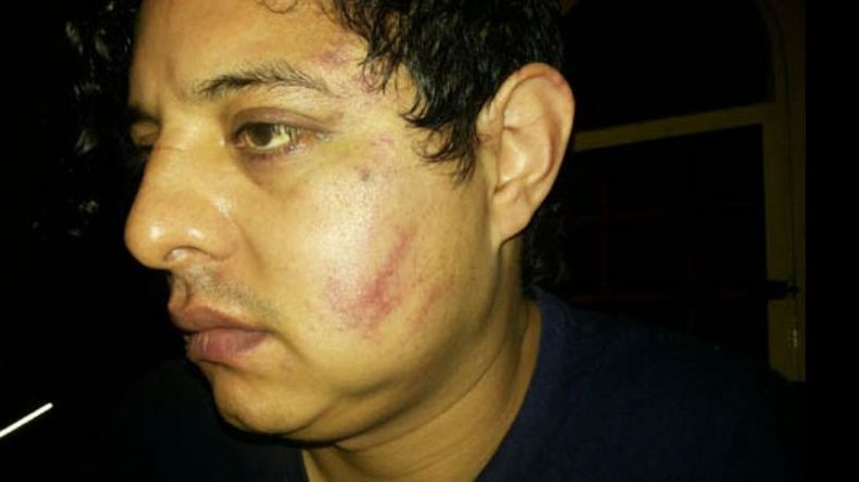 GOLPEADO. Sergio Rodríguez muestra las consecuencias de los golpes recibidos en el rostro y cabeza..
