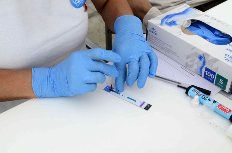 Los tres estudios para el control y seguimiento de pacientes con VIH ser llevado a cabo por la Provincia