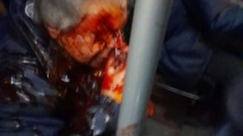 VIOLENTO. El chofer fue golpeado en la cabeza..