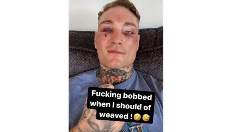 Rozicki se tomó con humor su look actual..