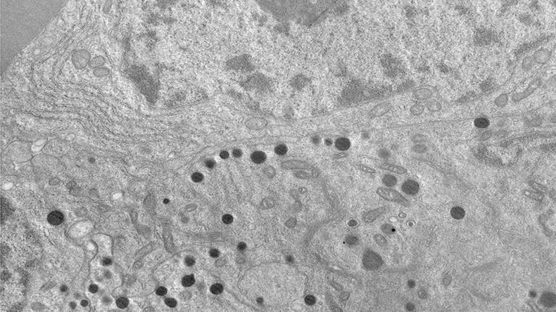 Células tumorales de pacientes con tumor somatotropo. (Conicet).jpg