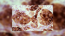 El CONICET lanzó la vacuna contra el cáncer de piel