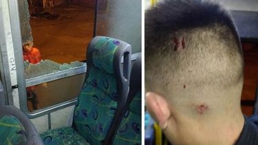 RESULTADO. Uno de los colectivos con la ventanilla rota. El pasajero muestras las heridas..