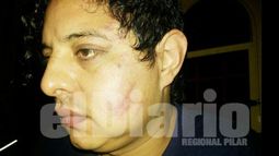 ASÍ QUEDÓ. Sergio Rodríguez mejora tras los golpes..