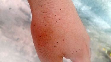 Alguien puede explicar qué carajo son estos bichitos y por qué una invasión? @Faacu_Miranda.