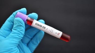 Detectan un caso de Covid-19 en una empresa y piden el cierre preventivo