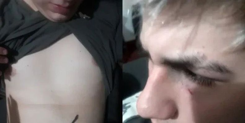 BRUTAL. El joven golpeado tiene 16 años.&nbsp;